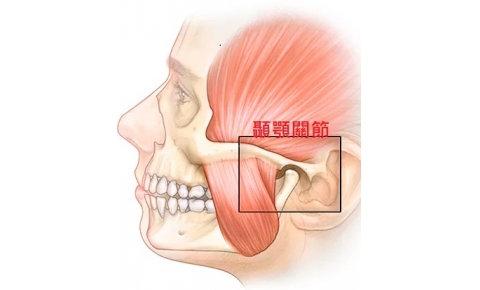 [ 顳顎關節炎 案例分享] 