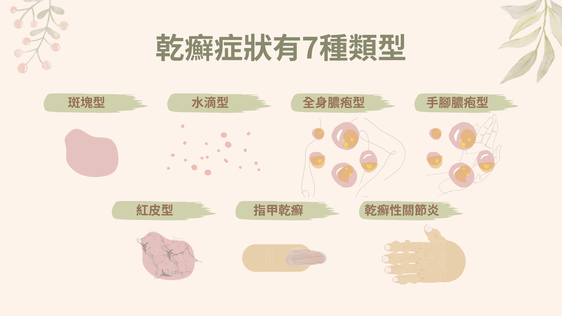 乾癬症狀和類型