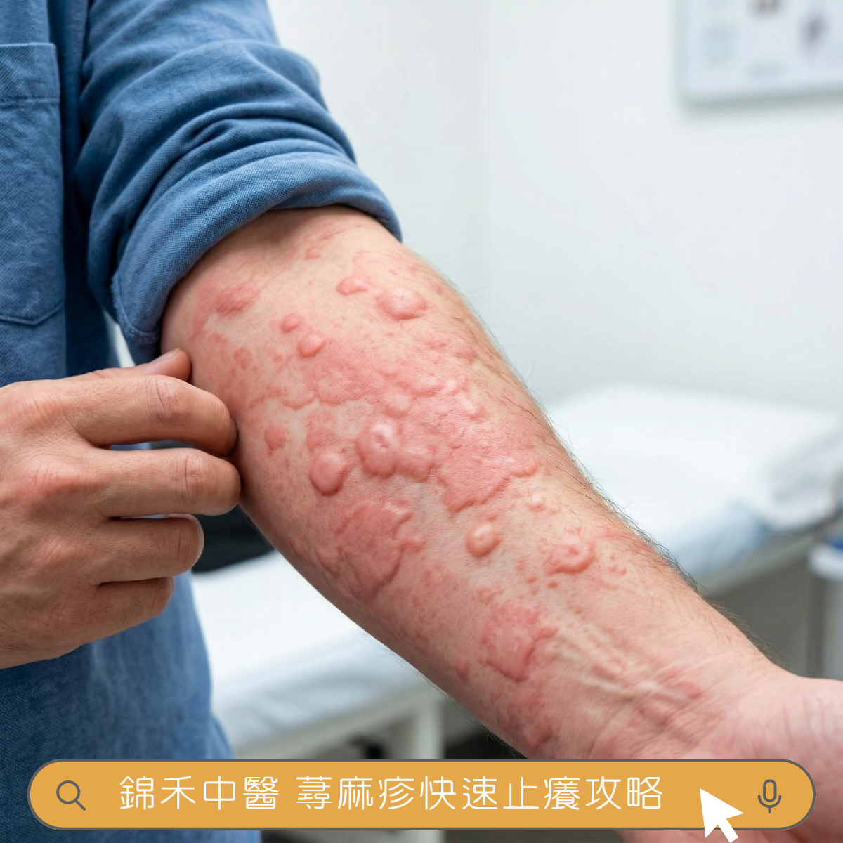 手臂蕁麻疹照片