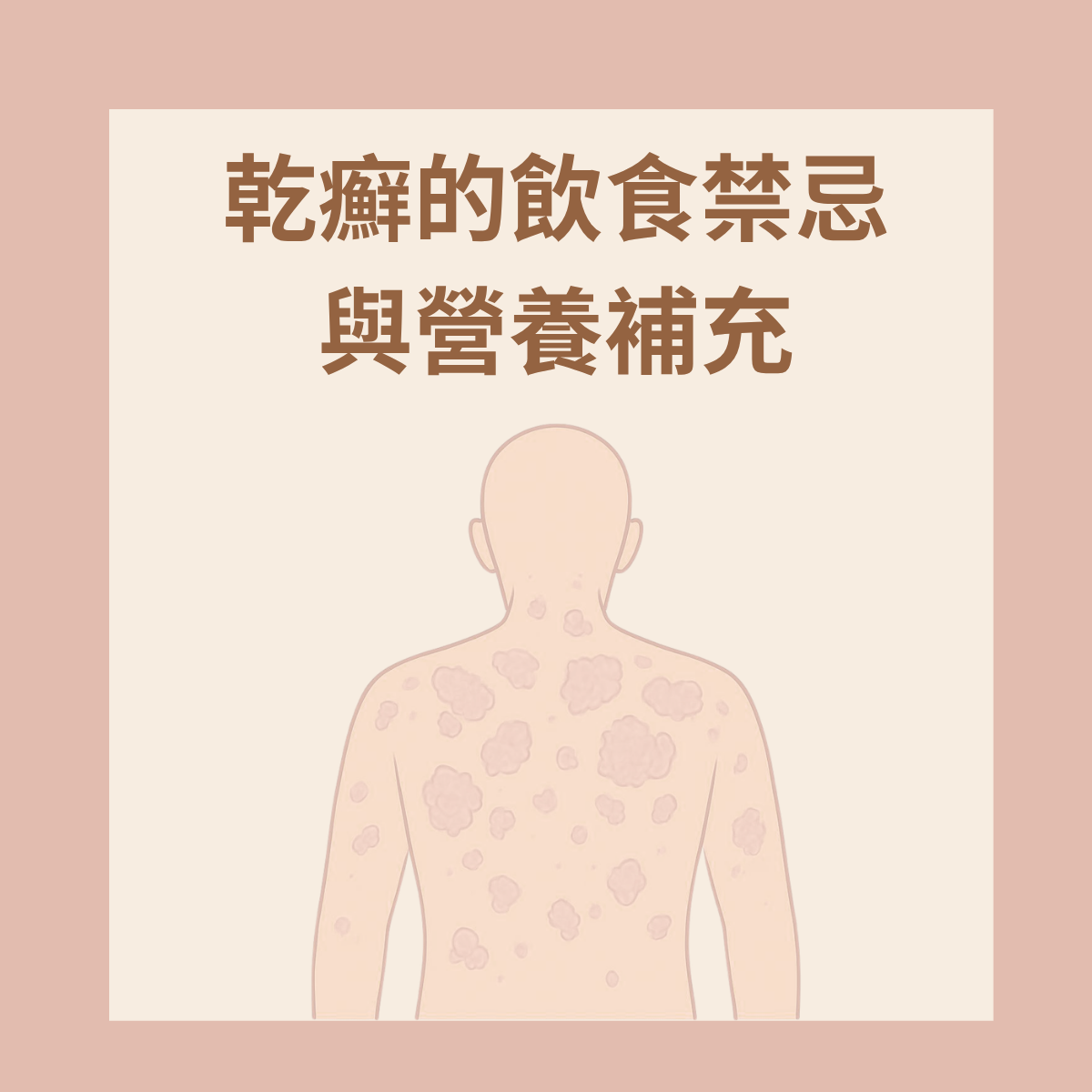 乾癬不能吃什麼